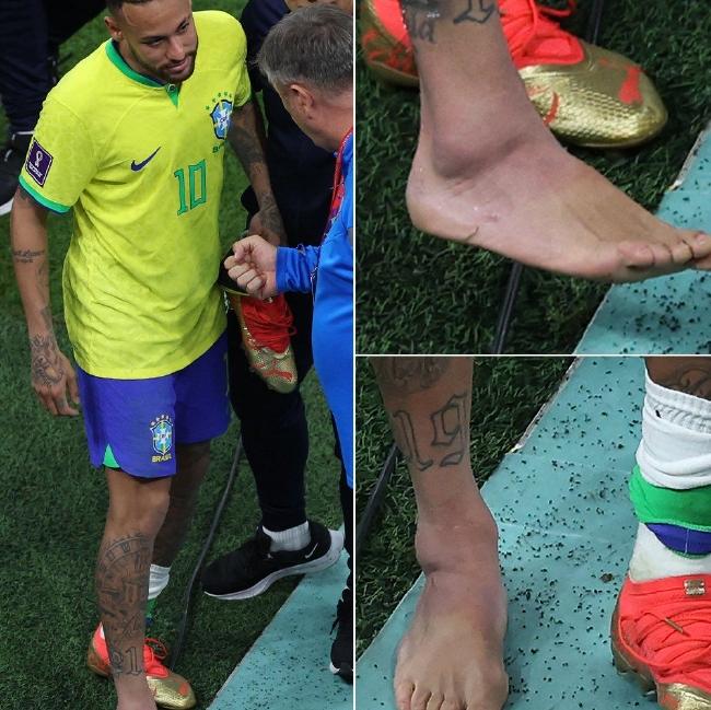 内马尔伤愈_内马尔伤情