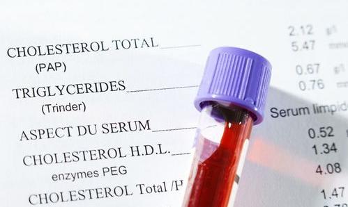 【甘油三酯高喝什么茶好】？ 甘油三酯高最怕一种茶