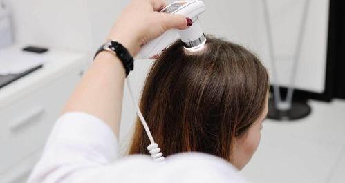 去头皮屑的洗发水推荐？ 酮康唑洗剂和二硫化硒洗头哪个好